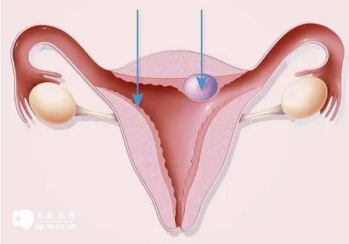 北京试管助孕公司：不用担心人工授精的孩子，和自然受孕一样